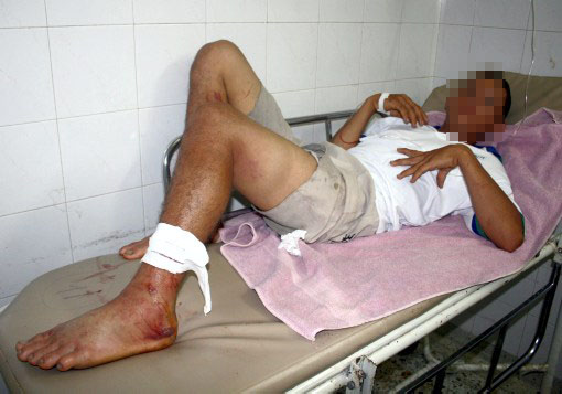 20 casos registrados por mordedura de serpientes en&nbsp;2014