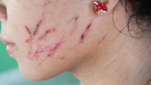 Menor de edad fue atacada y maltratada por su vecina000