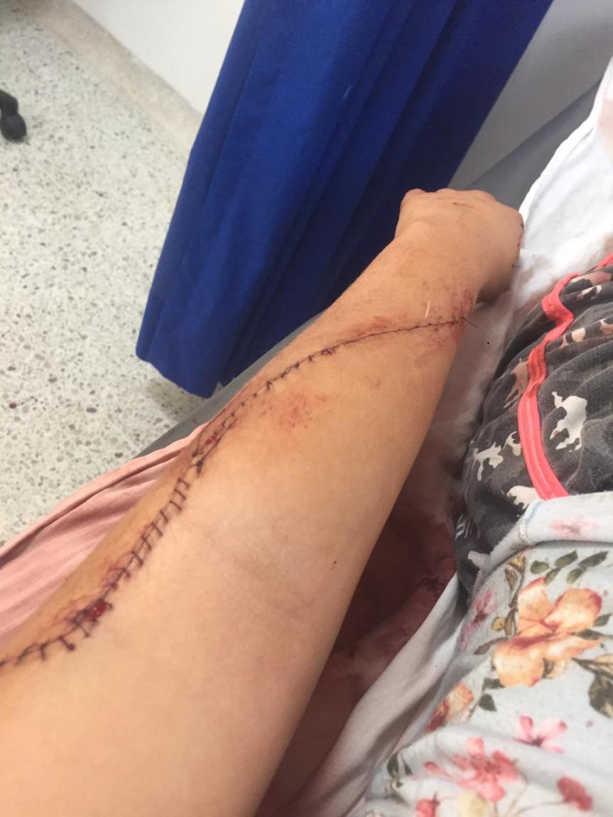 Enfermera poseída por los celos agredió con un bisturí a mujer en San Diego,&nbsp;Cesar